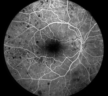 Eidon FA retina
