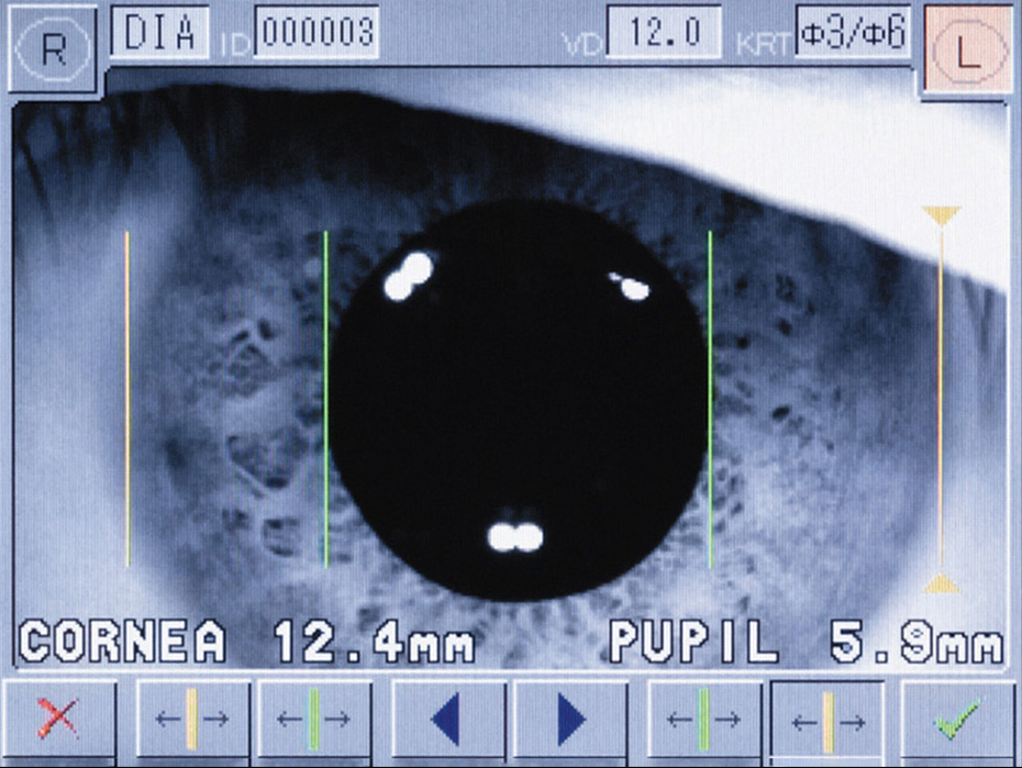 Autokeratorefraktometr RC-5000