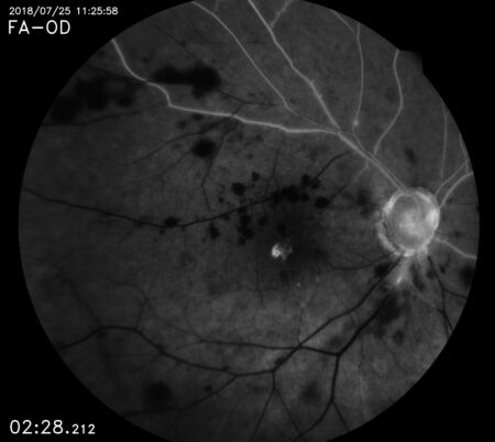 Eidon FA retina