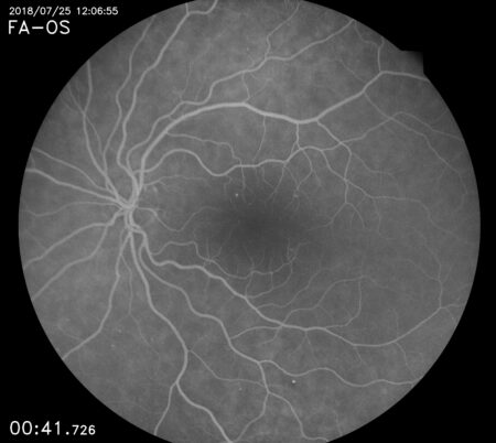 Eidon FA retina