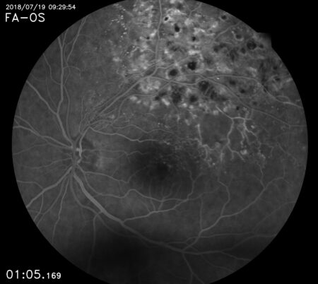 Eidon FA retina