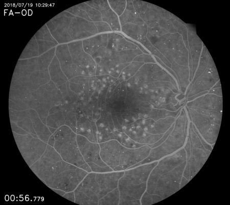 Eidon FA retina