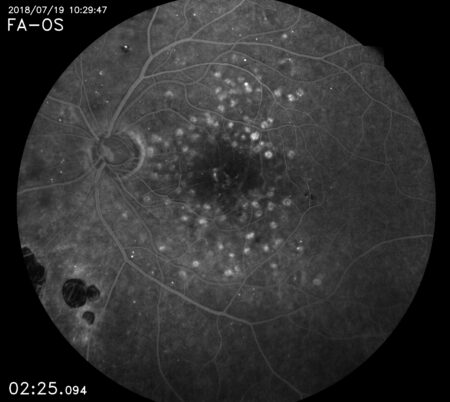 Eidon FA retina