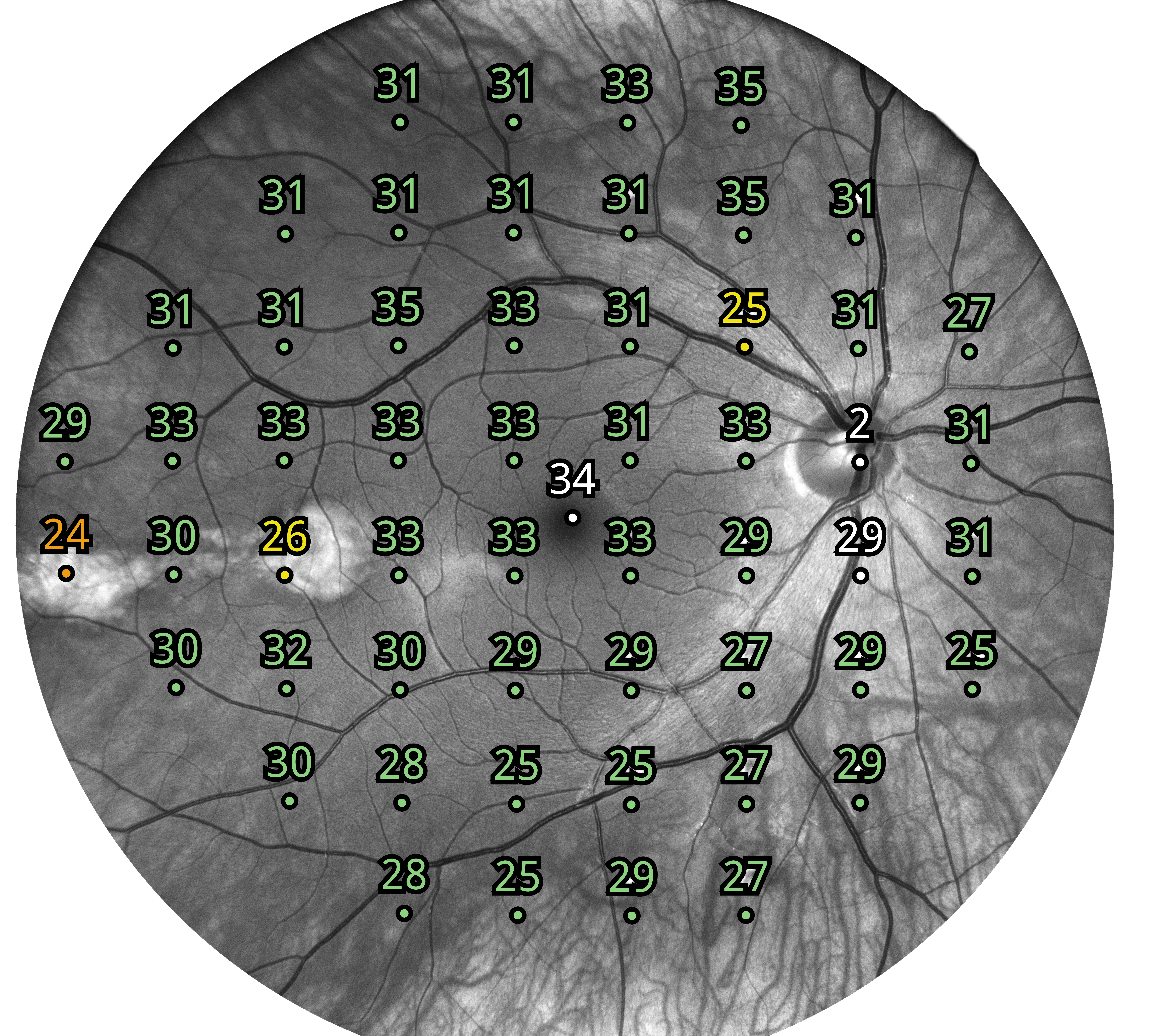 Perymetr komputerowy COMPASS
