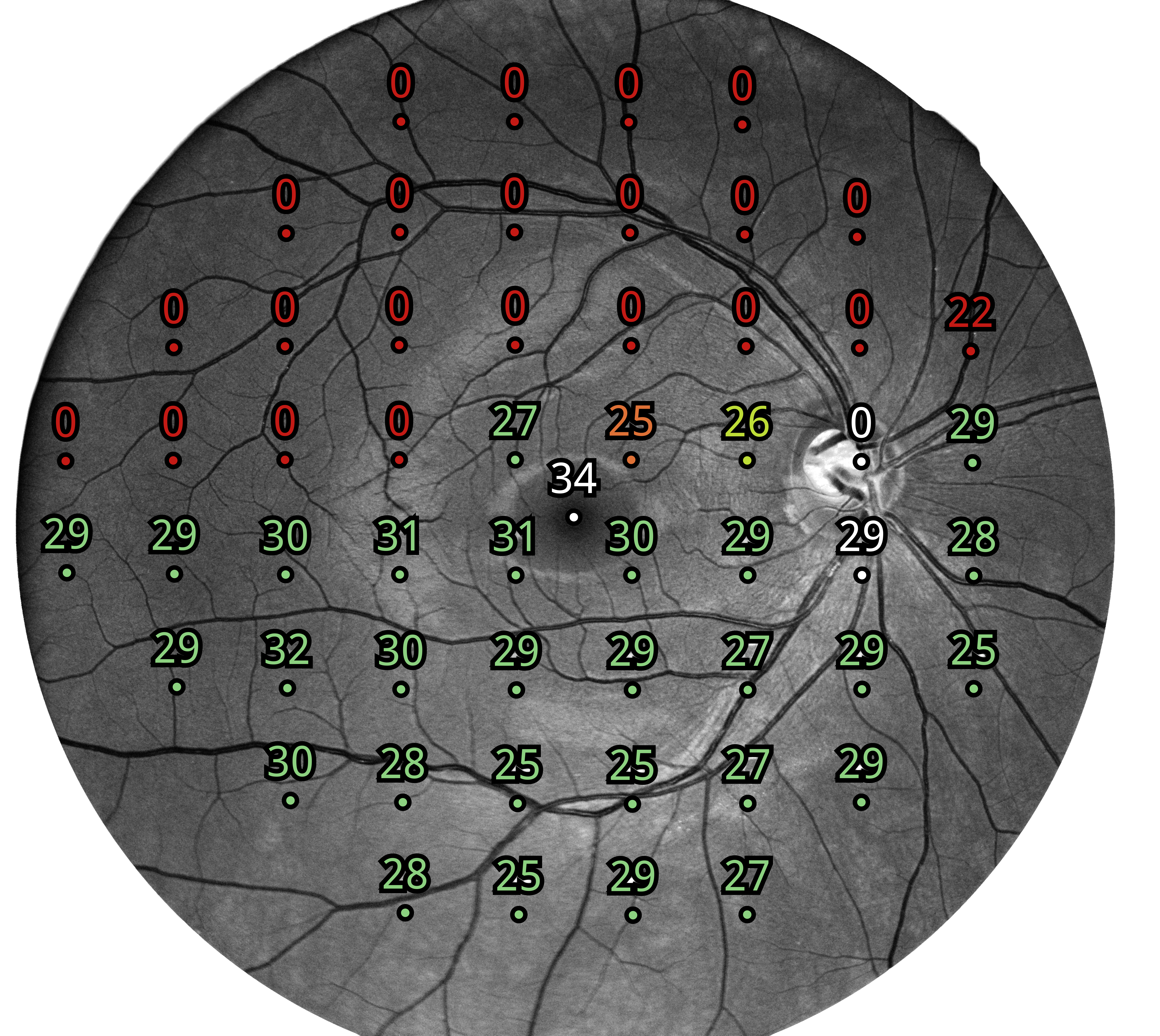 Badanie 24-2 z użyciem perymetru iCare COMPASS