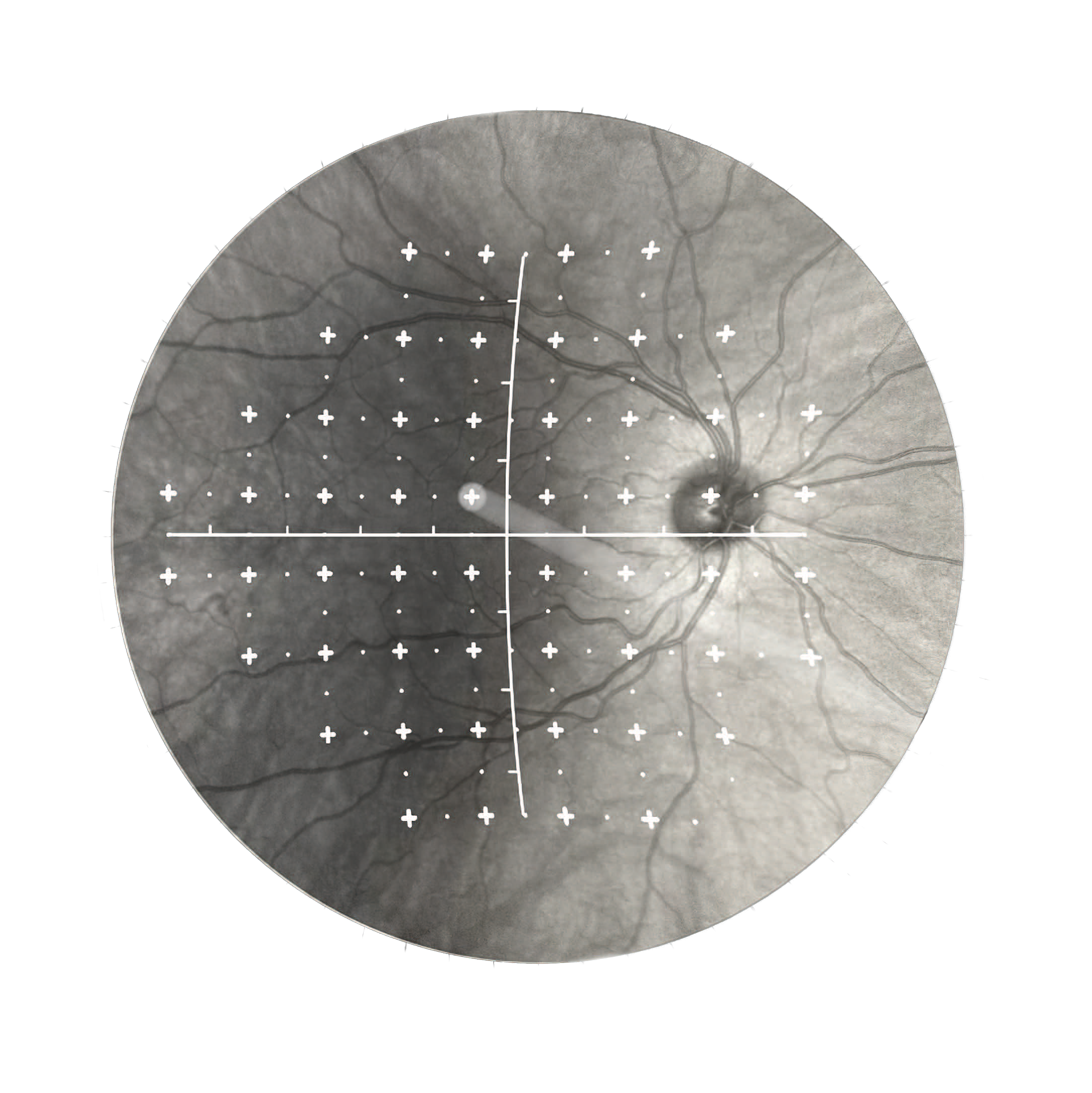 Aktywne śledzenie siatkówkowe