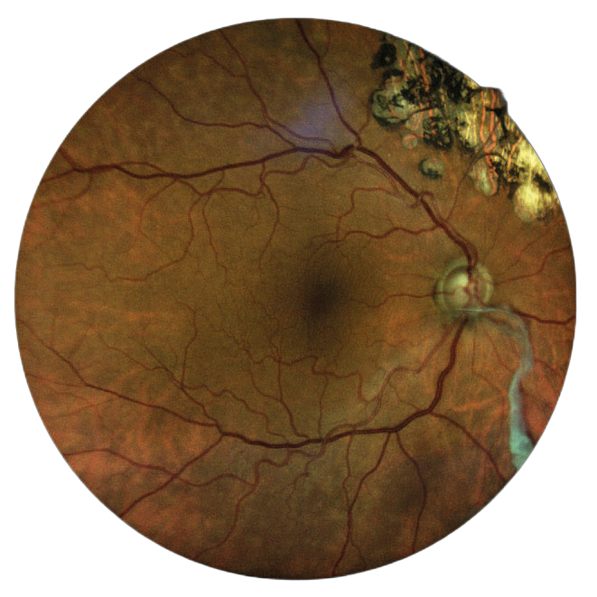 Perymetr komputerowy COMPASS