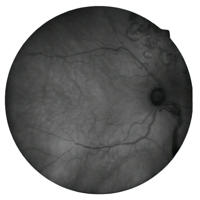 Perymetr komputerowy COMPASS