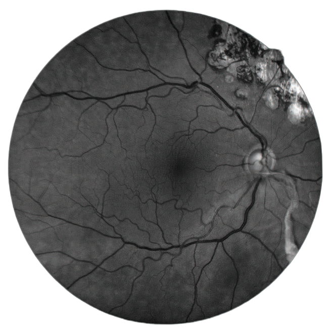 Perymetr komputerowy COMPASS