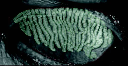 Automatyczne badanie NIBUT