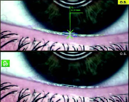 Automatyczne badanie NIBUT