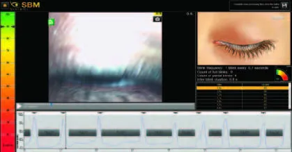 Automatyczne badanie NIBUT