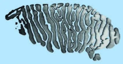 Automatyczne badanie NIBUT