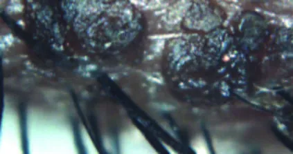 Automatyczne badanie NIBUT