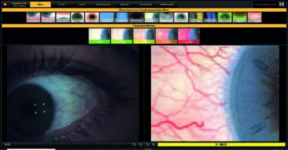 Automatyczne badanie NIBUT