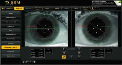 Automatyczne badanie NIBUT