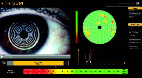 Automatyczne badanie NIBUT