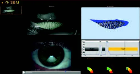 Automatyczne badanie NIBUT
