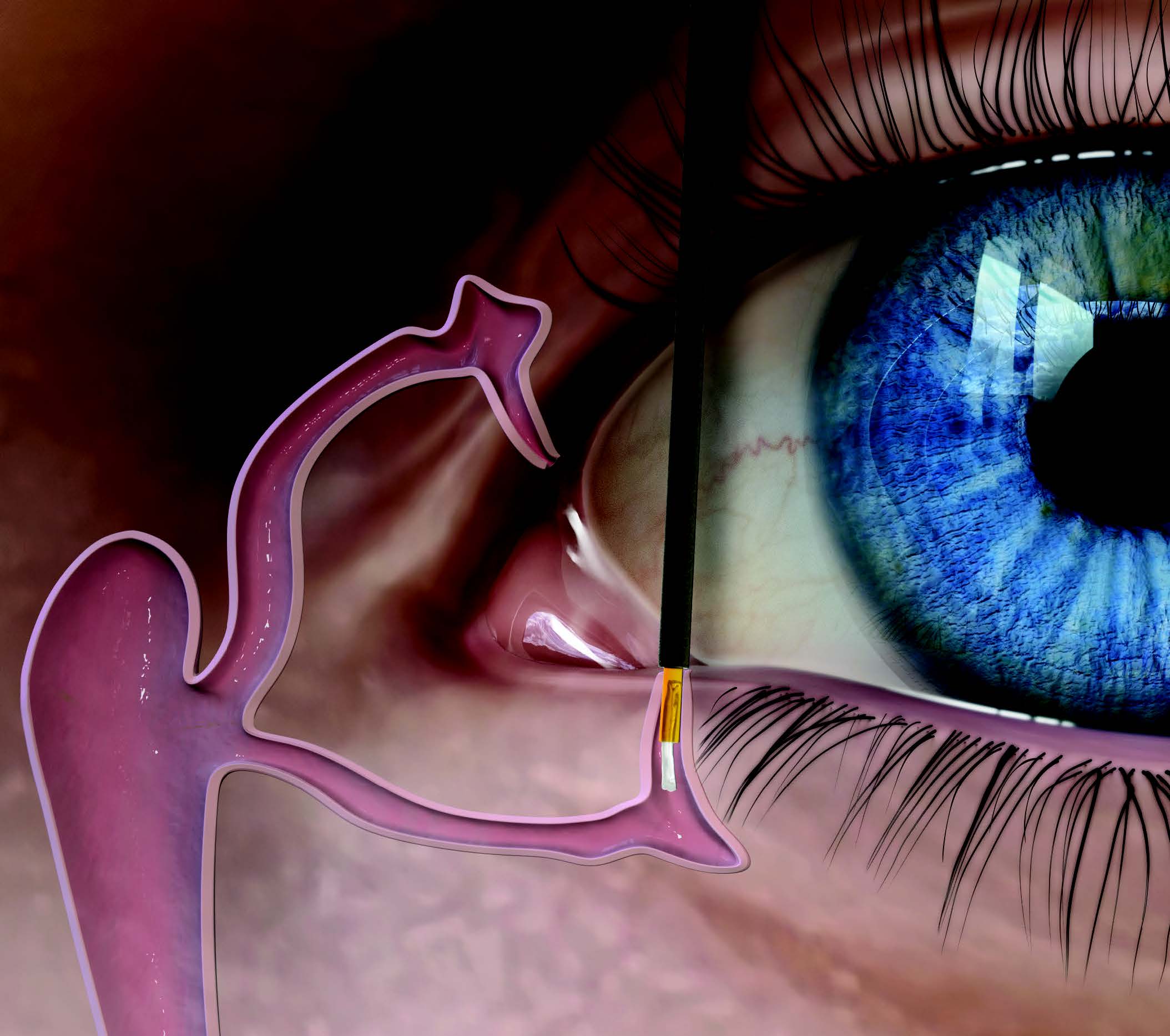 moment aplikacji zatyczki