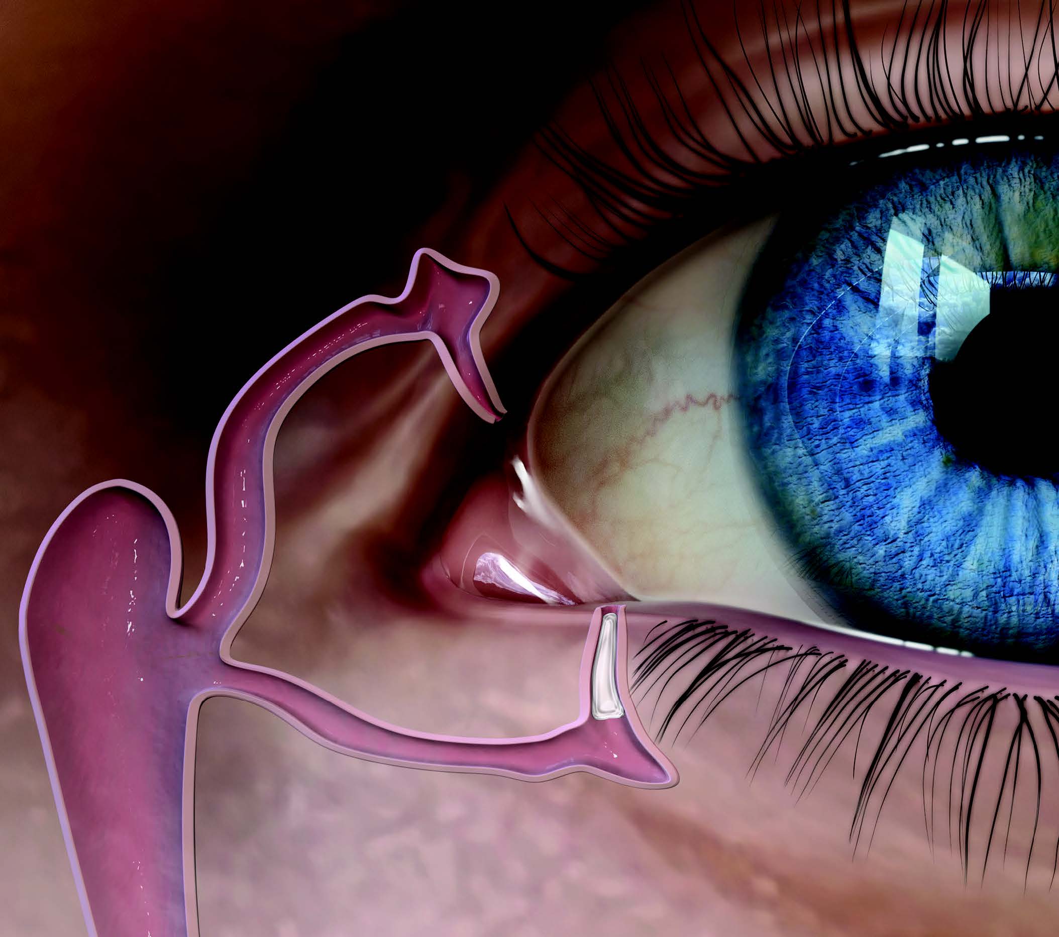 moment zaraz po aplikacji zatyczki