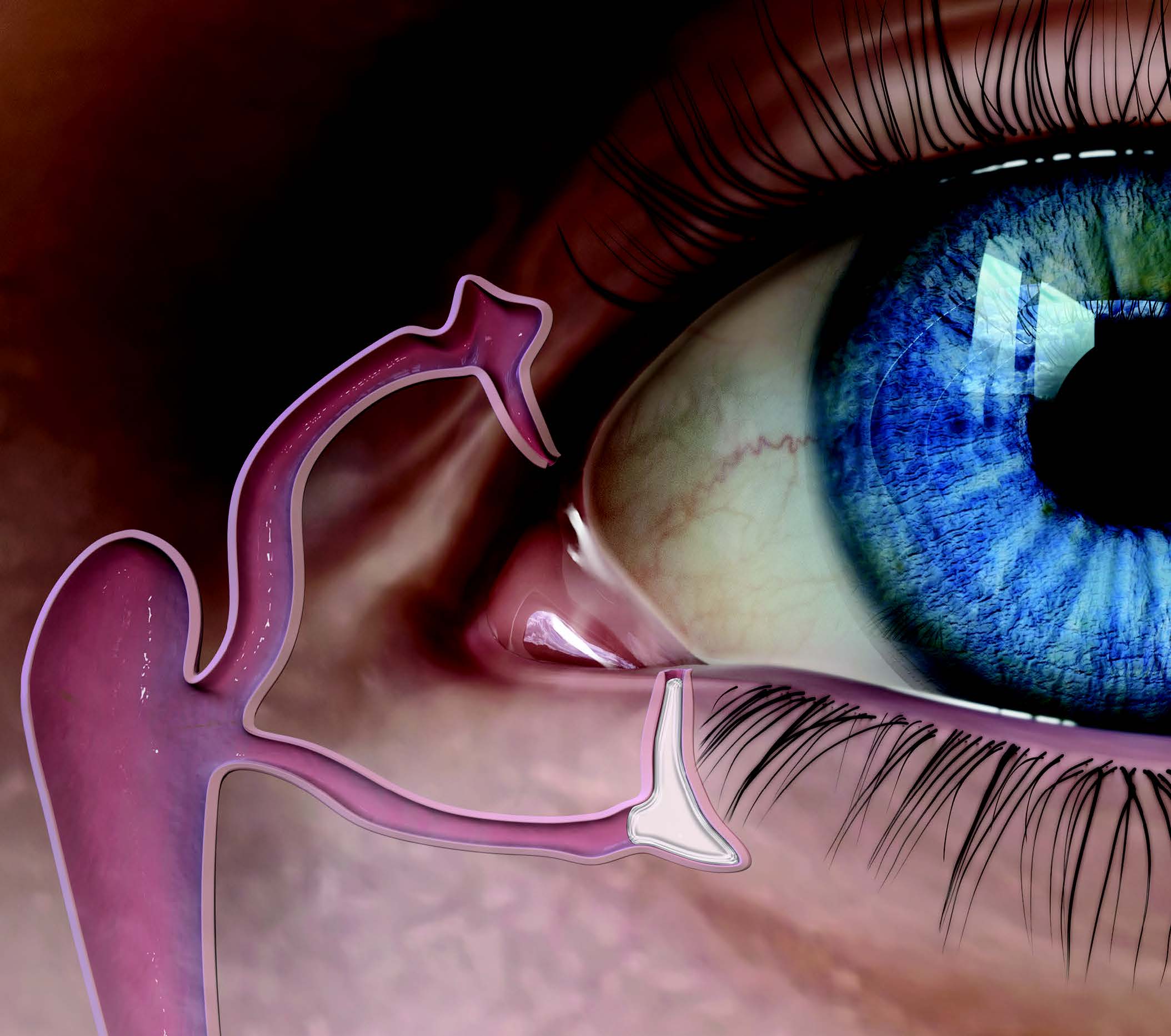 10 minut po aplikacji zatyczki